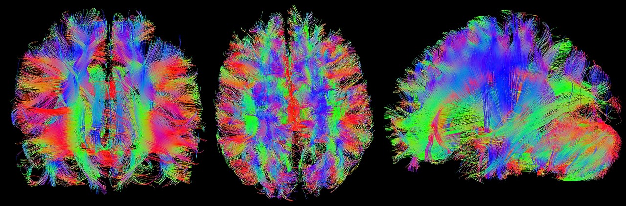 danni tessuto cerebrale declino cognitivo